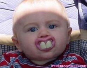 Bebe-con-dientes-de-conejo